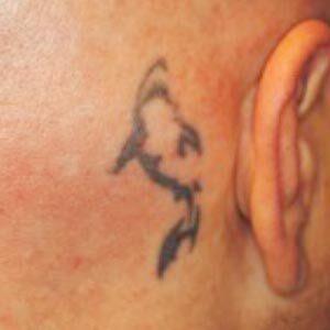 Before tattoo removal. Tattoo of a shark behind the client’s right ear.
