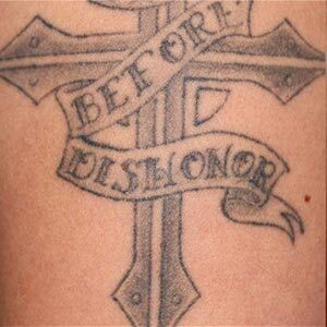 Before tattoo removal. Tattoo of a metal cross, wrapped in a ribbon with the words “Before Dishonor”.