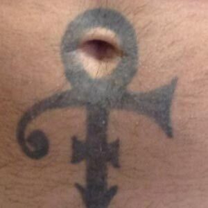 Before tattoo removal. Tattoo of Prince's "Love Symbol" on the client's stomach.
